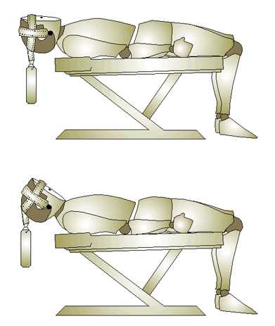 Flexión del cuello en decúbito supino